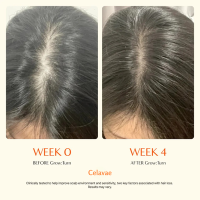 Korea's #1 Hair Growth Serum